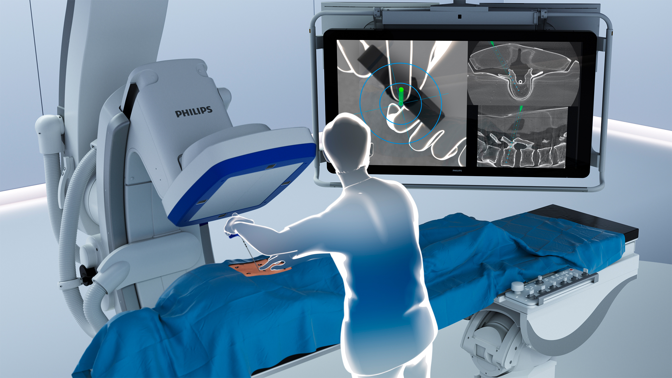 Image for Philips Introduces ClarifEye Augmented Reality Surgical Navigation To Advance Minimally-Invasive Spine Procedures